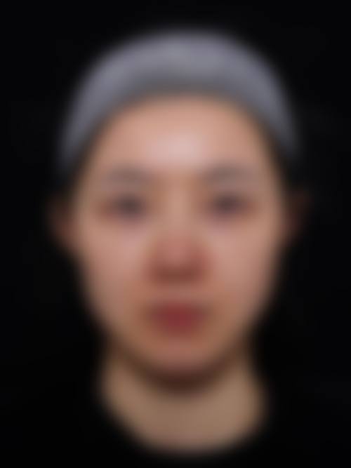 昆明悦格医疗美容如何预约?交通方便吗?