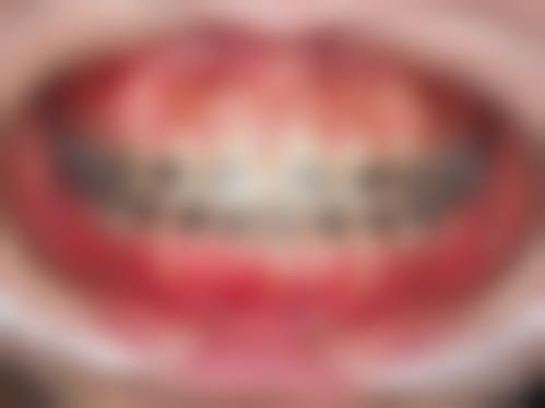 服务流程与患者保护：以患者为中 心