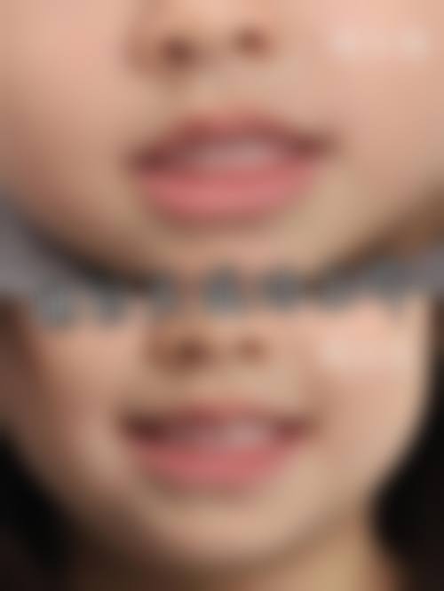 北海同步口腔(宁春城门诊)的技术优势体现在哪里