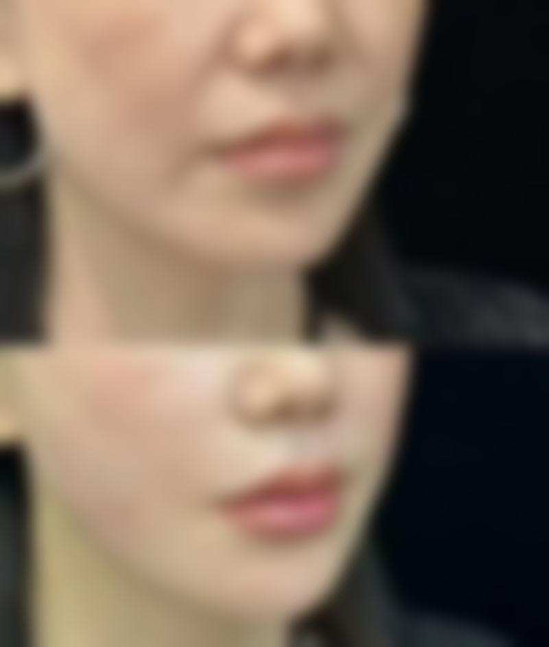 韓國jionu皮膚科怎麼預約掛號 適合邊類人群?3類港澳姊妹更啱!