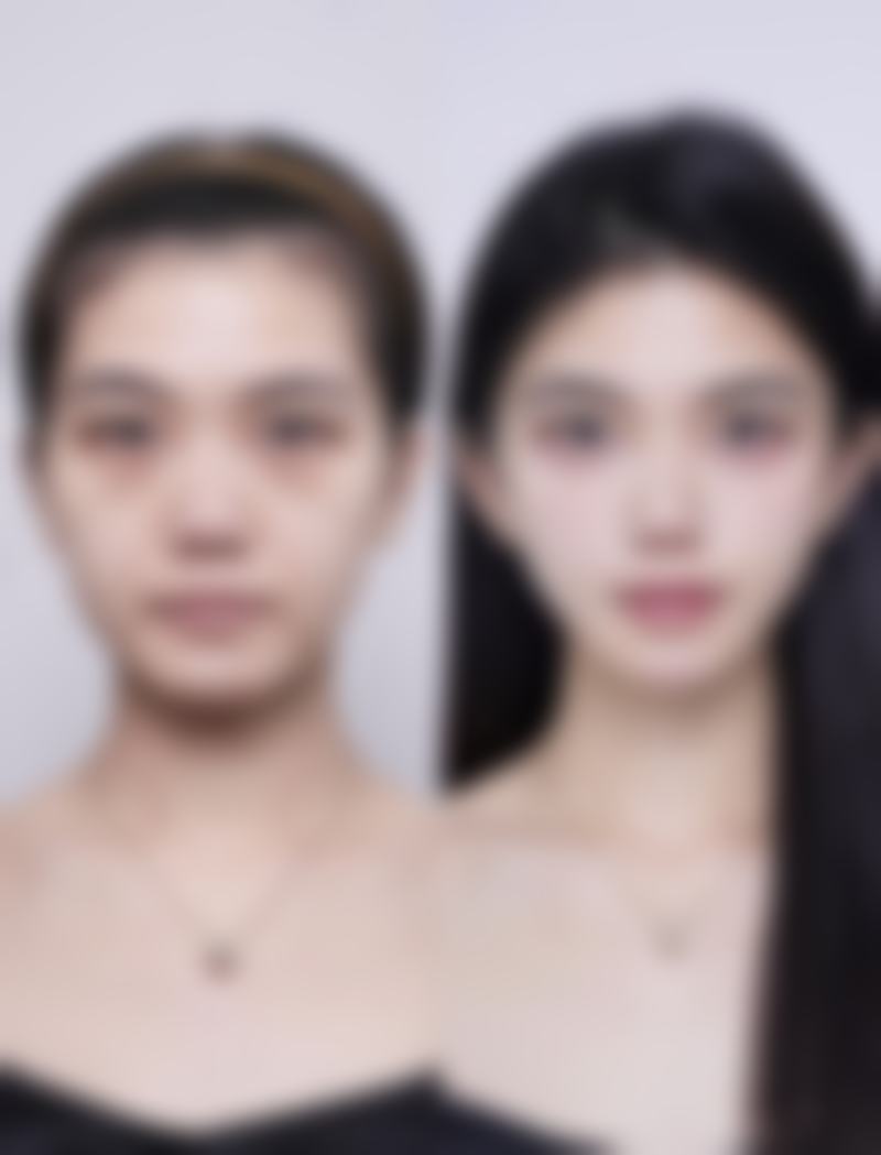 云南赫柏医疗美容医院擅长哪些项目?技术优势在哪里?