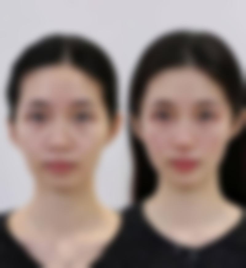 云南赫柏医疗美容医院口碑如何?这些真实好评值得参考
