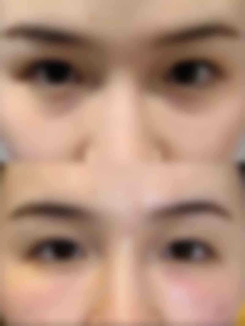 【澳門街坊專區】韓國jionu皮膚科怎麼預約掛號 澳門邊度好?珠海口岸平價選擇!