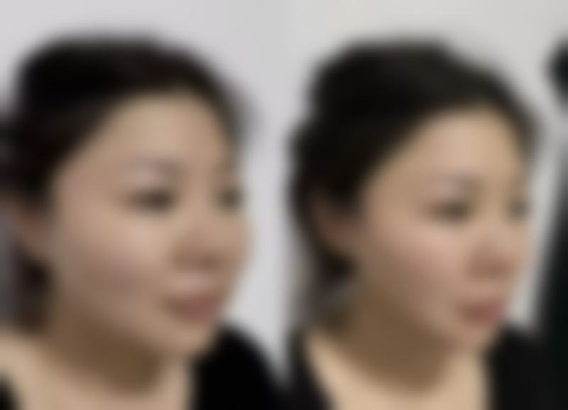 北京博美医疗整形美容医院怎么预约挂号?