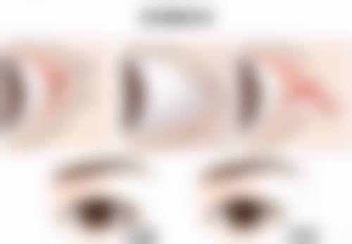 韓國鼻整形真實心得：診所揀選要點（香港/澳門姊妹必睇）